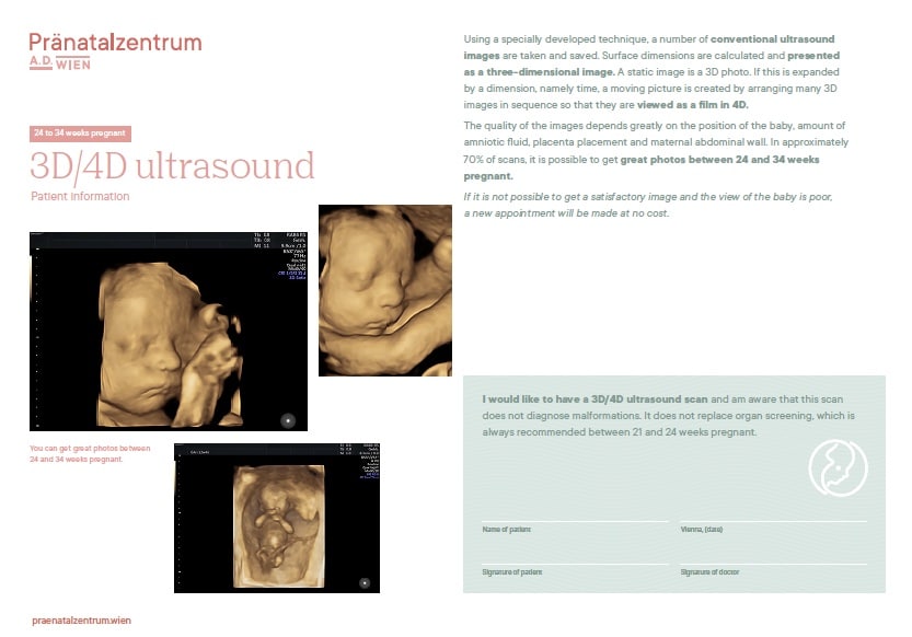 Information about 3D/4D ultrasound